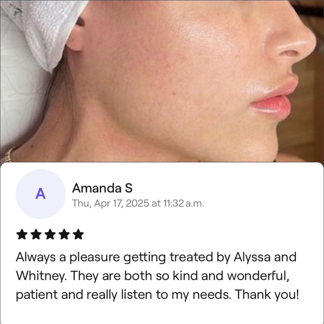 Professional chemical peel treatment a 5 star review saying how much the client was satisfied with the treatment.