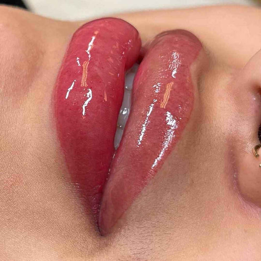 Stunning Lip Blush and Neutralization Results at SKN Deep Cosmetic Clinic, Grimsby Ontario