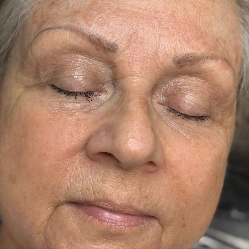 Before - 12 Year Old Brow Tattoo