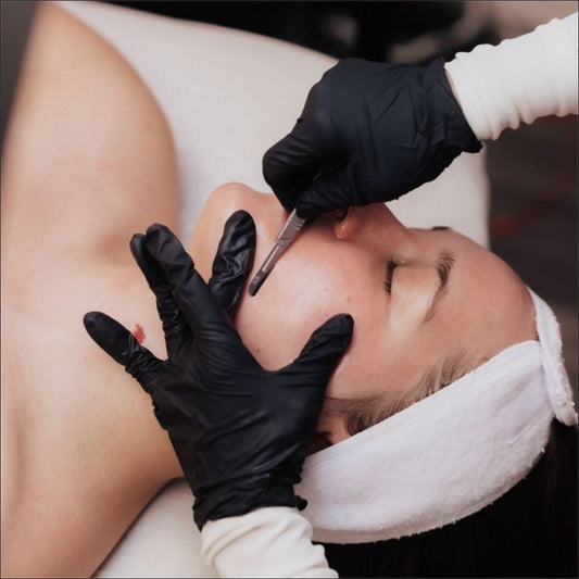 Close-up of a skincare specialist using a scalpel to gently exfoliate dead skin cells and remove peach fuzz from a client’s face. The client lies relaxed on a treatment table with a white headband, while the specialist wears black gloves for precision and hygiene.