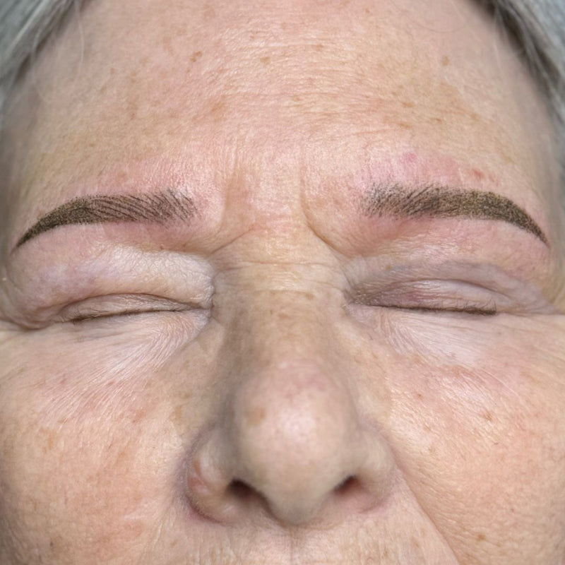 After - Combo brow for hair loss