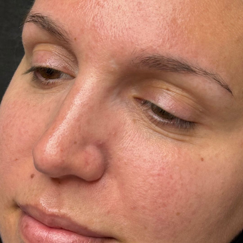 Close-up of a woman's face showing sparse brows with missing arches before getting nano brows service performed at SKN Deep Cosmetic Clinic in Grimsby.