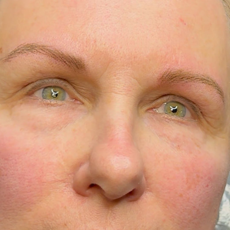 Close-up of a person's face showing nano brow results after performed at SKN Deep Cosmetic Clinic in Grimsby.