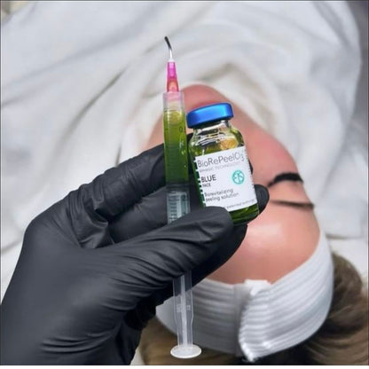 Close-up of a gloved hand holding a syringe with green BioRePeelCl3 solution and a vial labeled 'BLUE,' prepared for a TCA chemical peel treatment at a beauty cosmetic clinic. The background features a client ready for professional skincare.